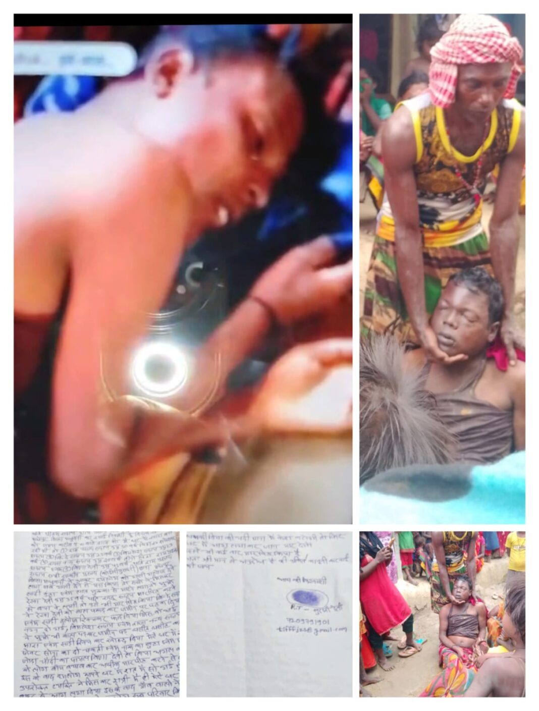 घर में आगजनी और मारपीट, घायल कई, भाई की साजिशन हत्या का आरोप