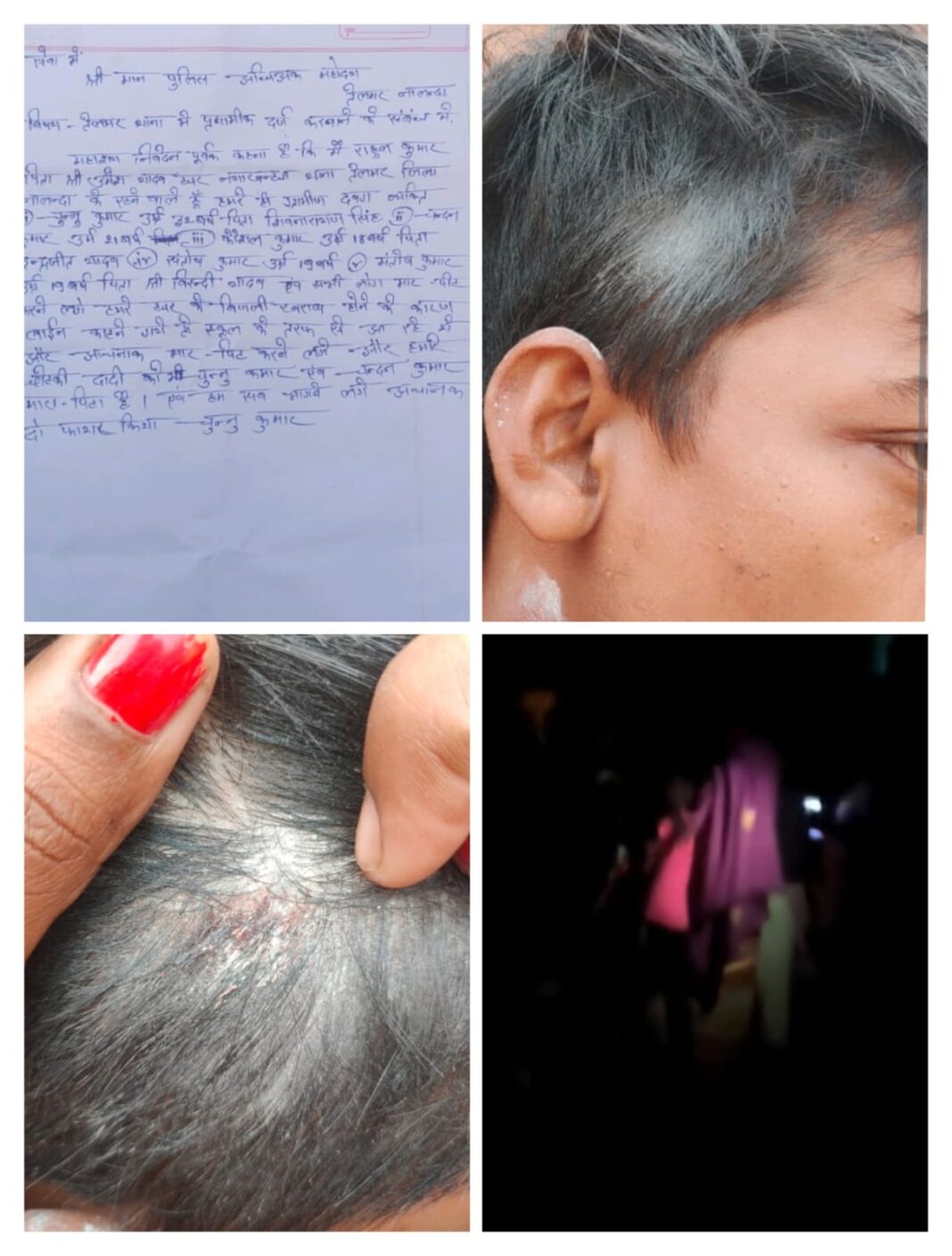 तेलमर में दबंगों का हमला: युवक और दादी पर मारपीट, दो राउंड फायरिंग से दहशत