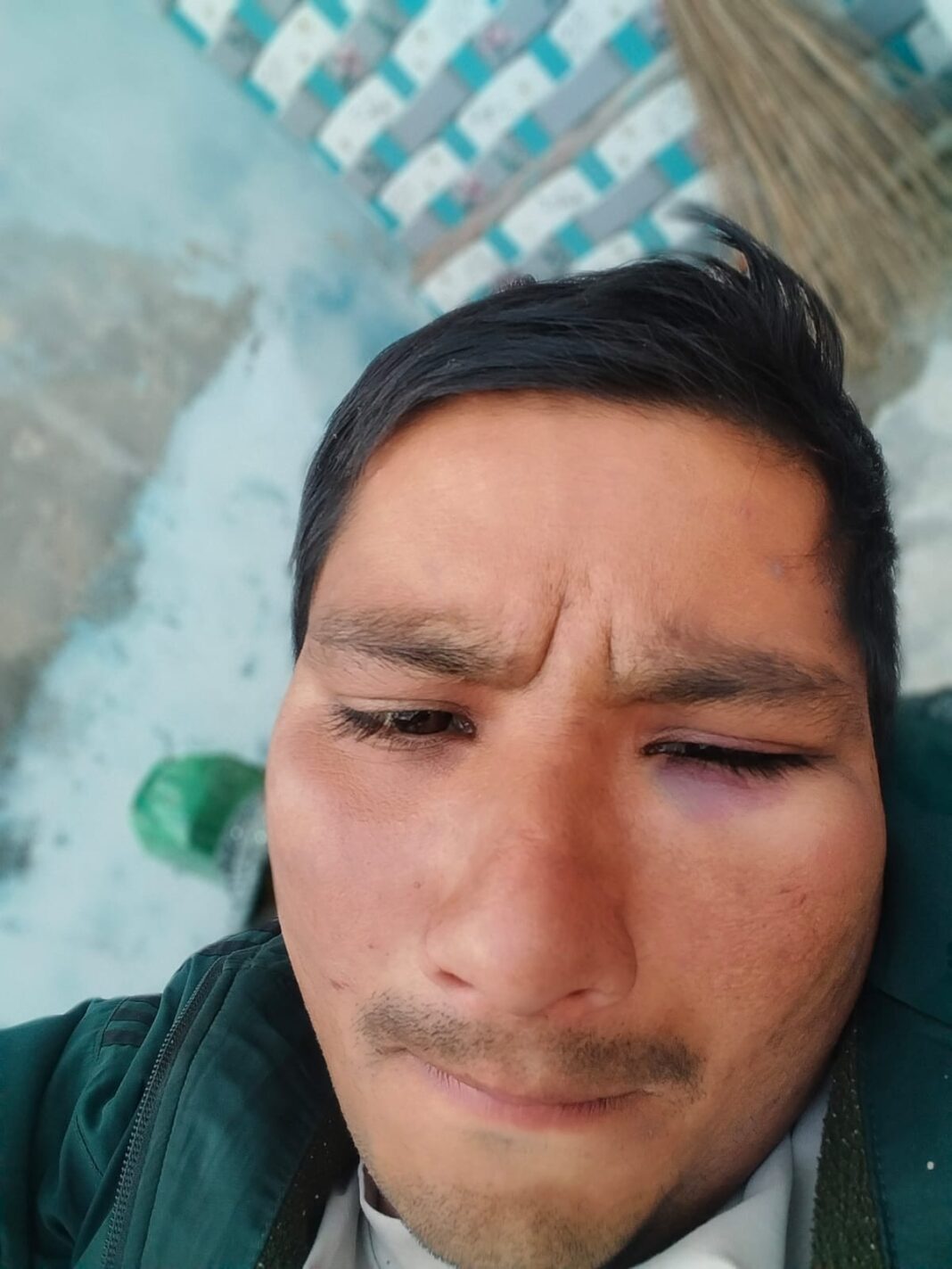 अलीगढ़ में रंजिश का तांडव: वीरेश पर दो बार जानलेवा हमला, पड़ोसियों पर गोली चलाने और मारपीट की कोशिश का आरोप