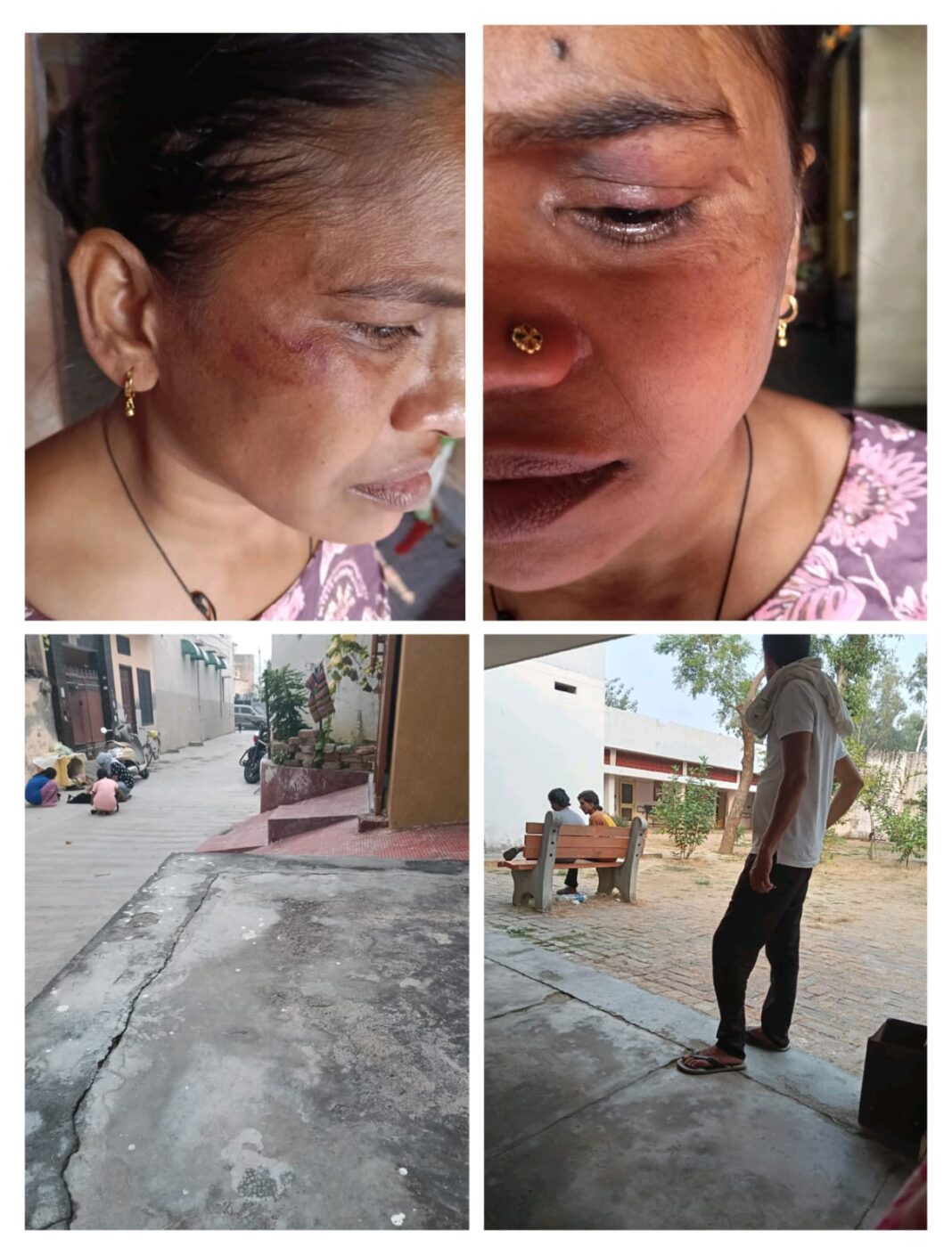 सोनीपत में महिला पर हमला: मोहल्ले की सुषमा और उसके साथियों पर मारपीट का आरोप, कुत्तों के विवाद से भड़की हिंसा – पुलिस से लगाई न्याय की गुहार