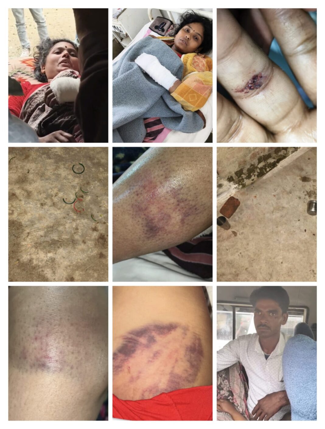 ग्राम देवलापुर में घरेलू विवाद ने लिया खौफनाक मोड़ — सास-ससुर ने बहू को पीटा, ससुर पर गलत संबंध बनाने का आरोप